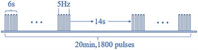 Efficacy of repetitive transcranial magnetic stimulation at different sites for peripheral facial paralysis: a prospective cohort study